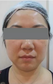 After Arbeaute
